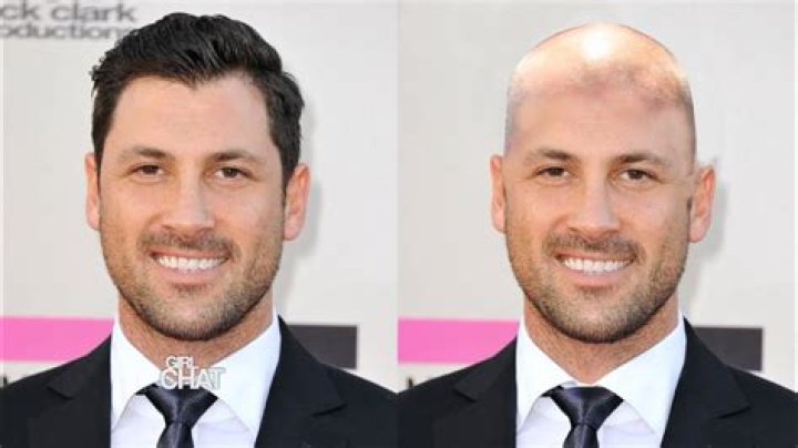 Are bald men attractive?