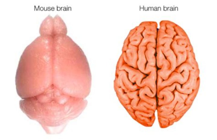 Are brains squishy?