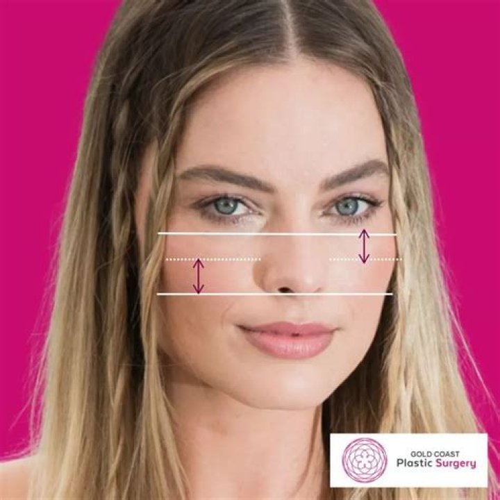 Are cheekbones attractive?