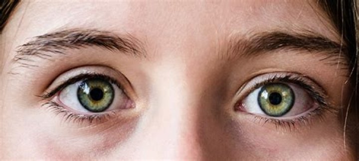 Are green eyes more sensitive?