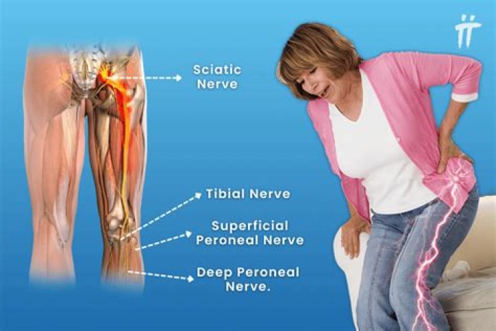 Are hot baths good for sciatica?