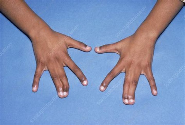 Are human hands webbed?
