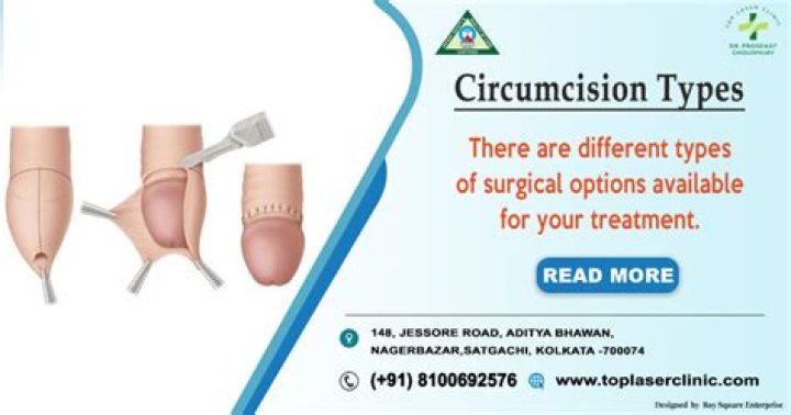 Are Maasai circumcised?