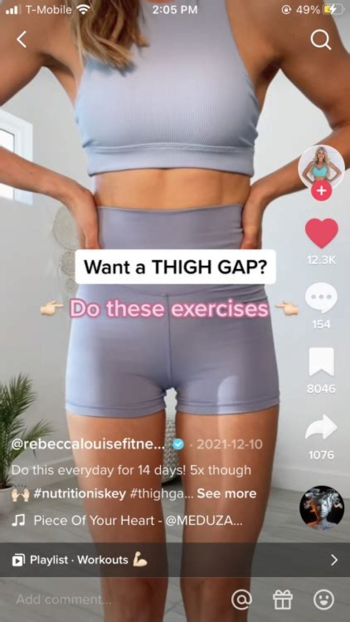 Are thigh gaps genetic?