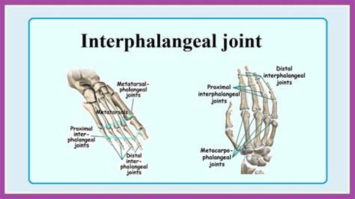 Are U-joints hard to replace?