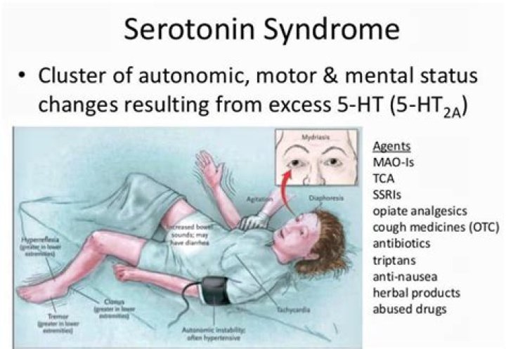 Can 5-HTP cause serotonin syndrome?