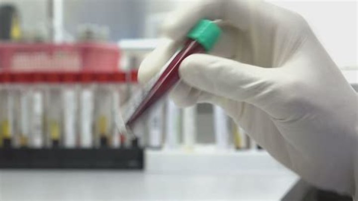 Can a blood test tell if you had a seizure?