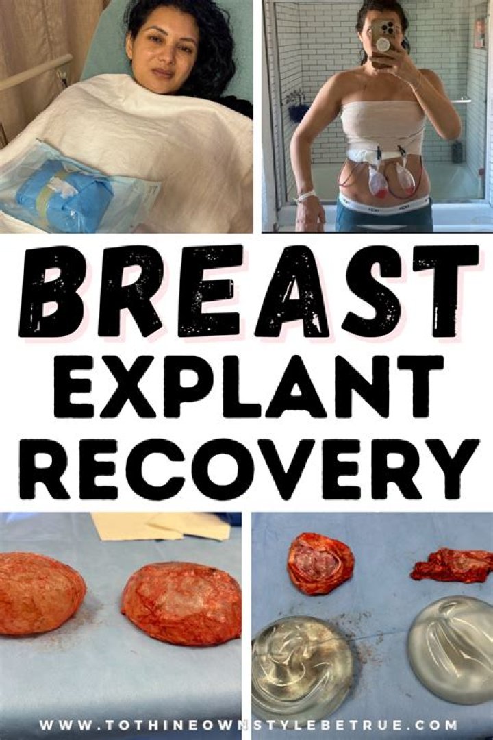 Can a fallen breast rise again after breastfeeding?