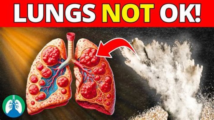 Can a Kirby not inhale?