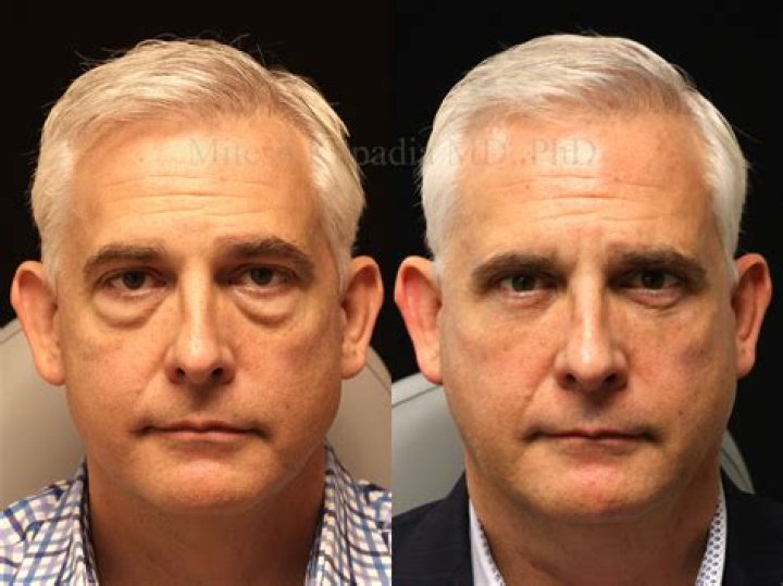 Can a PA do surgery?