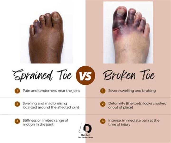 Can a stubbed toe hurt for days?