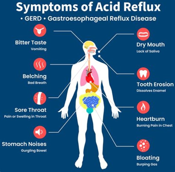 Can acid reflux cause back pain?