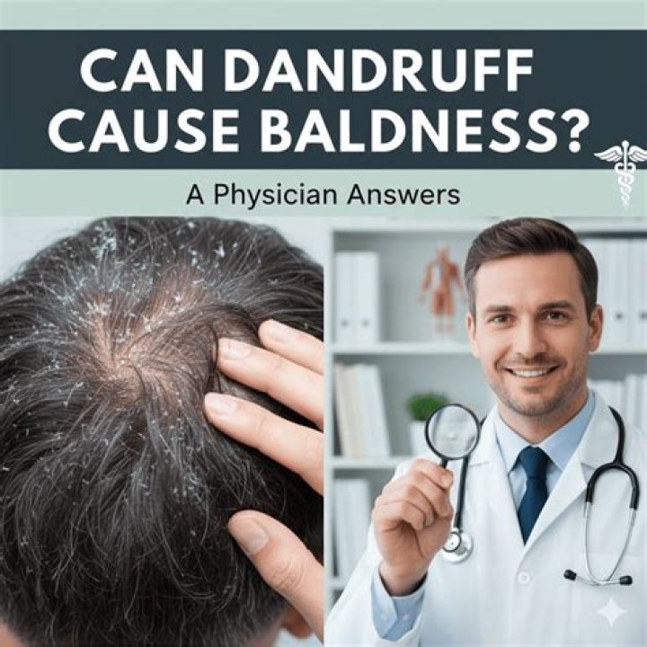 Can anti-dandruff shampoo cause baldness?