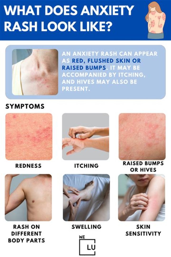 Can anxiety cause rashes?