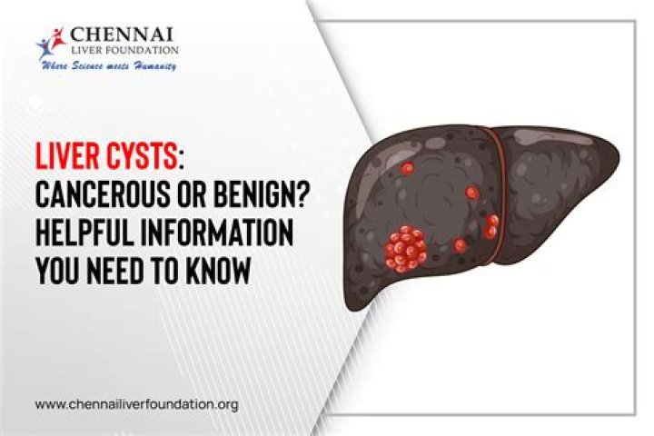 Can benign cysts turn cancerous?