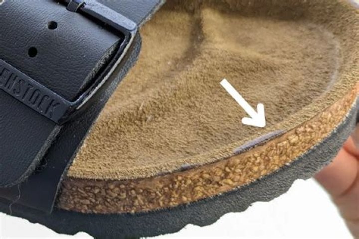 Can Birkenstocks damage your feet?