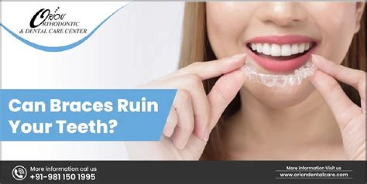 Can braces ruin your teeth?
