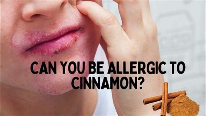 Can cinnamon cause allergies?