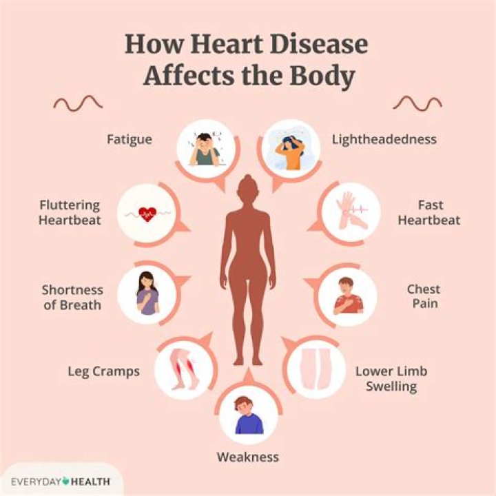 Can diverticulitis affect your heart?