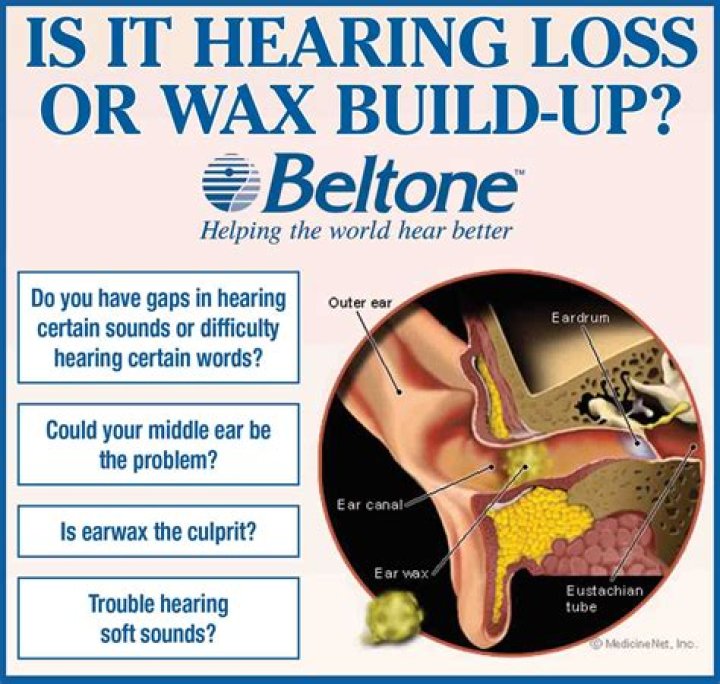 Can earwax cause hearing loss?