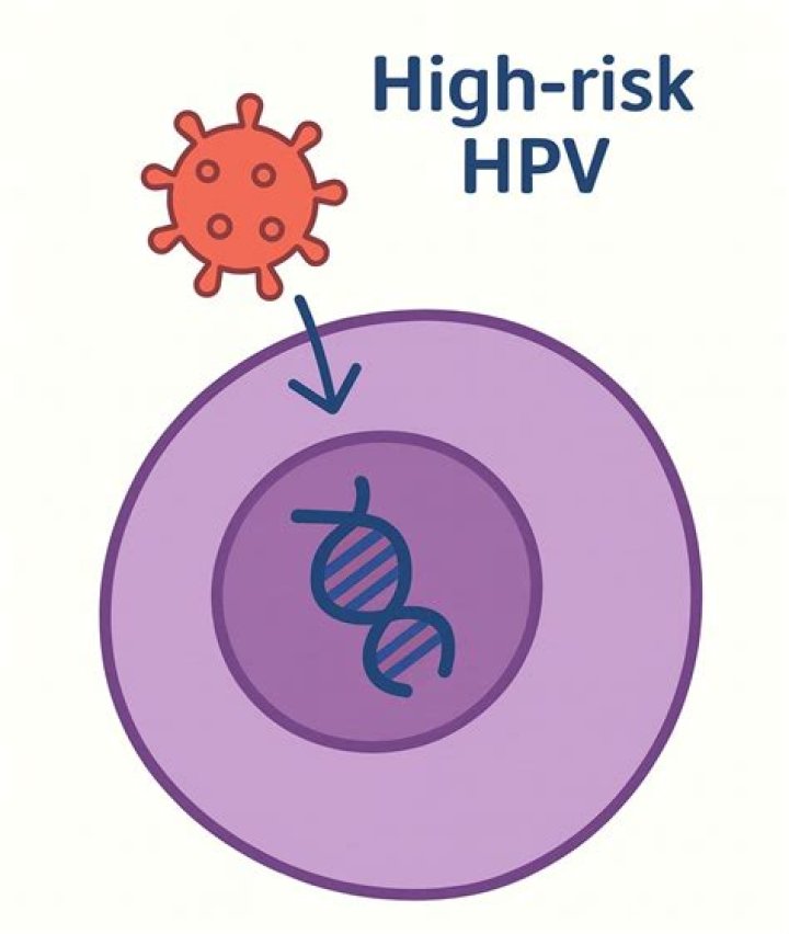 Can high risk HPV be treated?