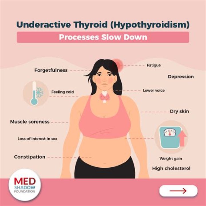 Can hypothyroidism be cured?