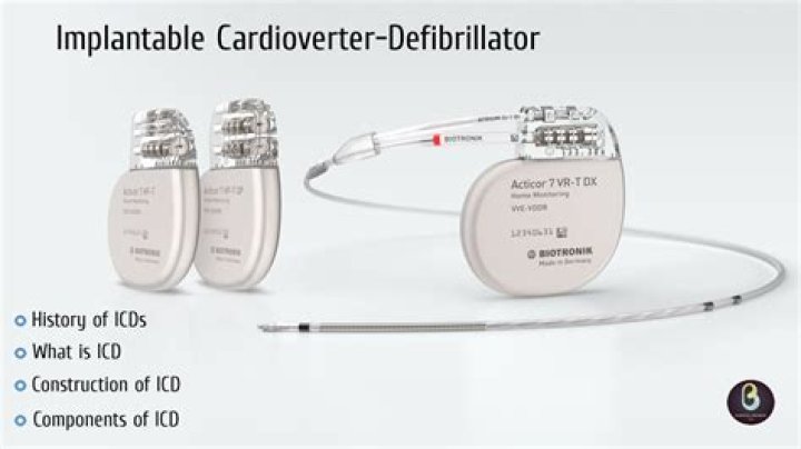 Can I drive after having an ICD fitted?