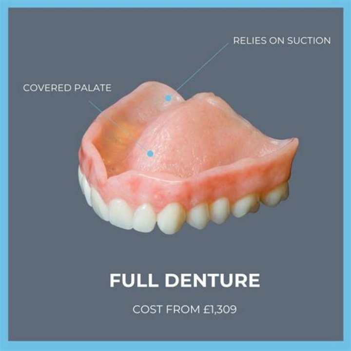 Can I have all my teeth pulled and get dentures UK?