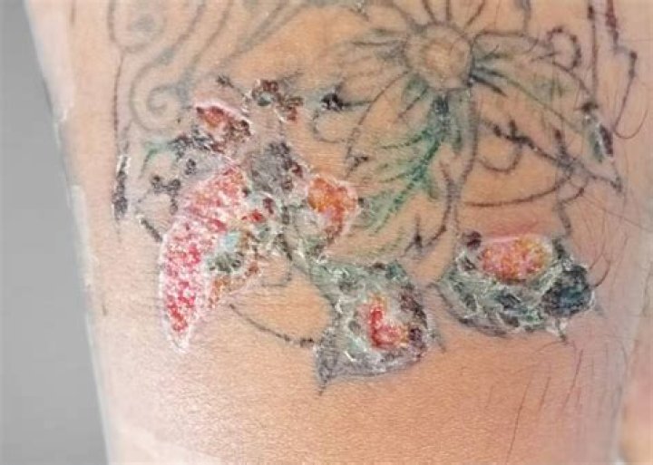 Can I sleep on my tattoo when it's peeling?