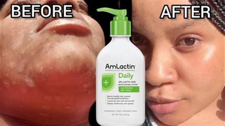 Can I wear face lotion before surgery?