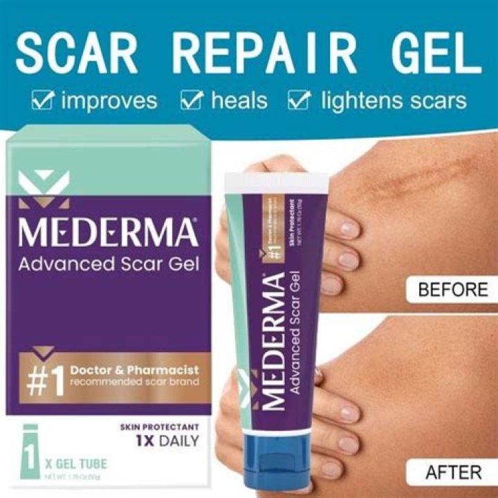 Can Mederma remove old scars?