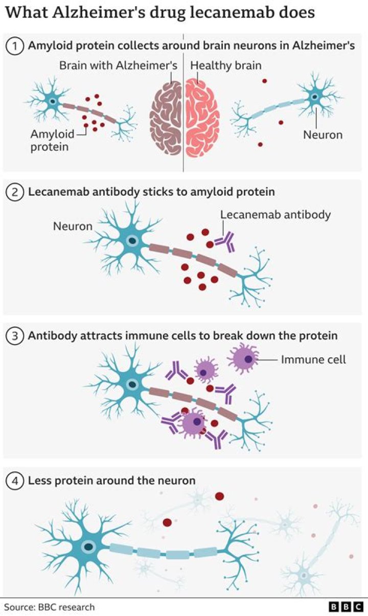Can melatonin cause Alzheimer's?