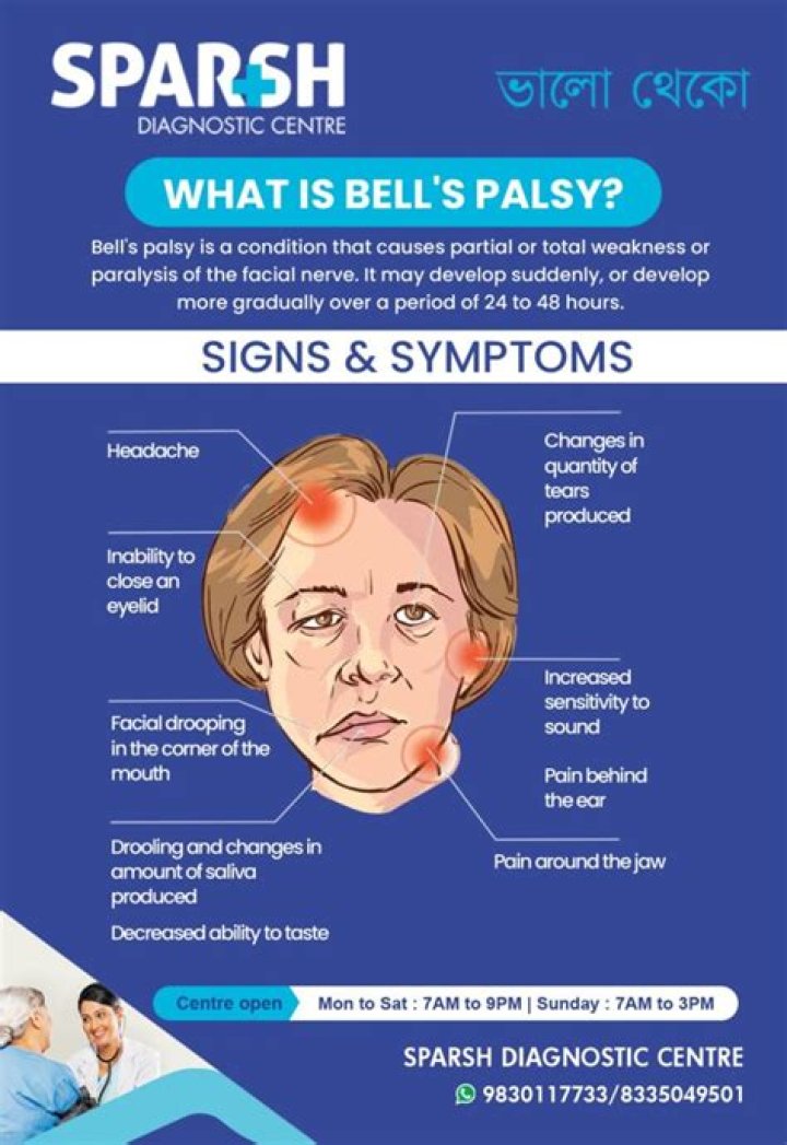 Can MS be mistaken for Bell's palsy?