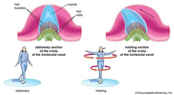 Can otoconia be removed?