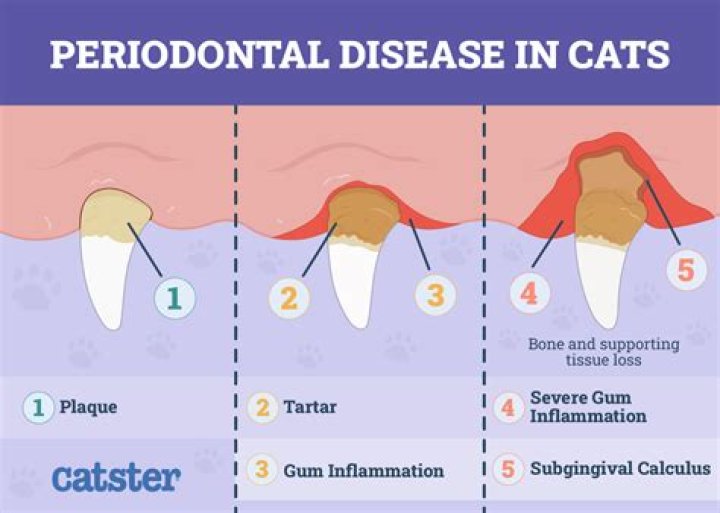 Can periodontitis go unnoticed?