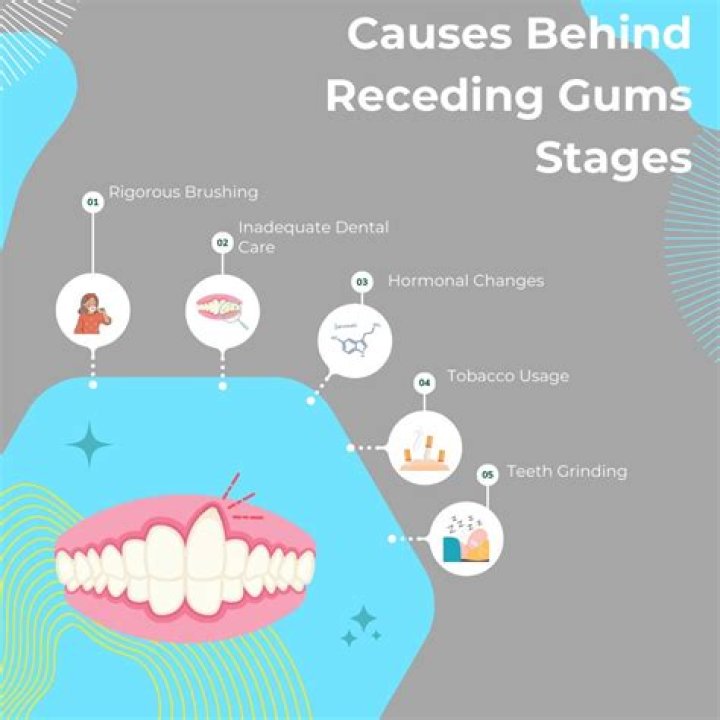 Can receding gums move back?
