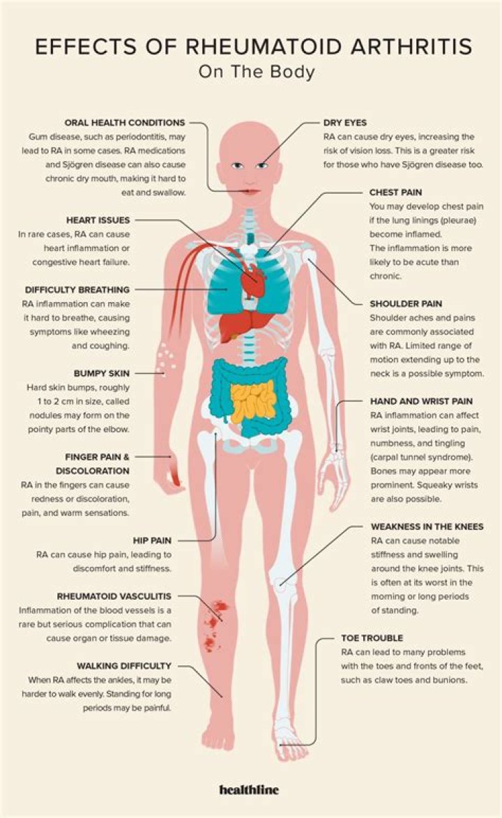 Can rheumatoid arthritis affect your stomach?