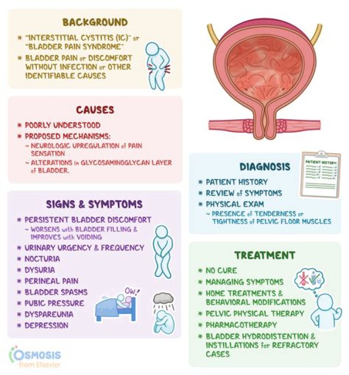 Can Sjogren's affect the bladder?