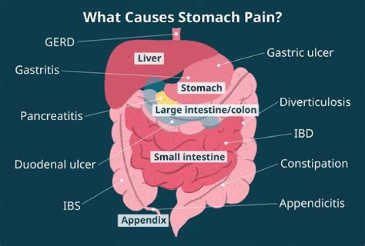 Can stress cause stomach spasms?