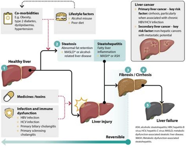 Can the liver repair itself after cirrhosis?