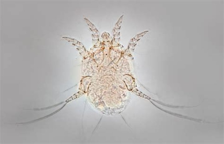 Can u see scabies with the human eye?