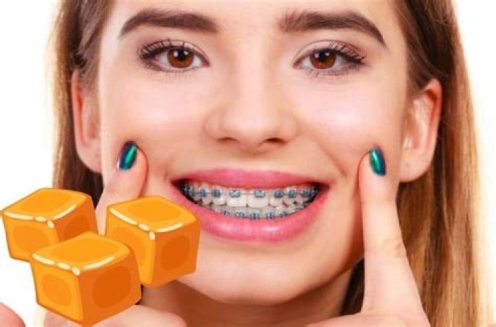 Can you eat caramel with braces?