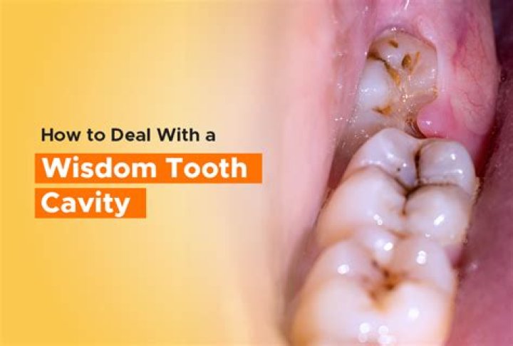 Can you feel a cavity with your finger?