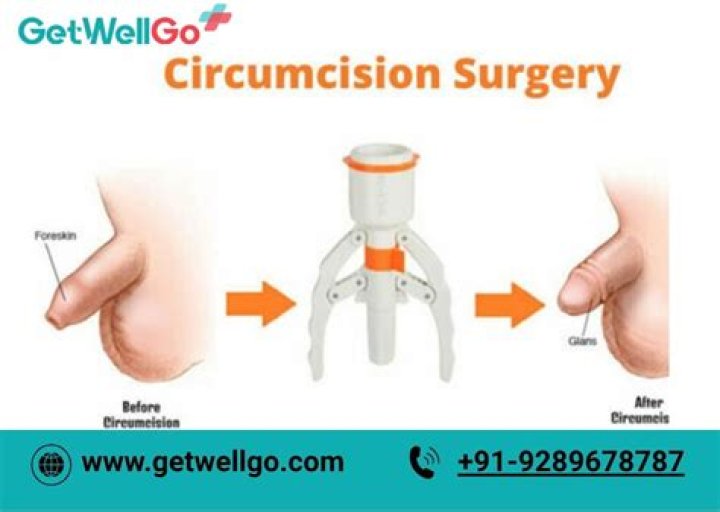 Can you get circumcised after 30?