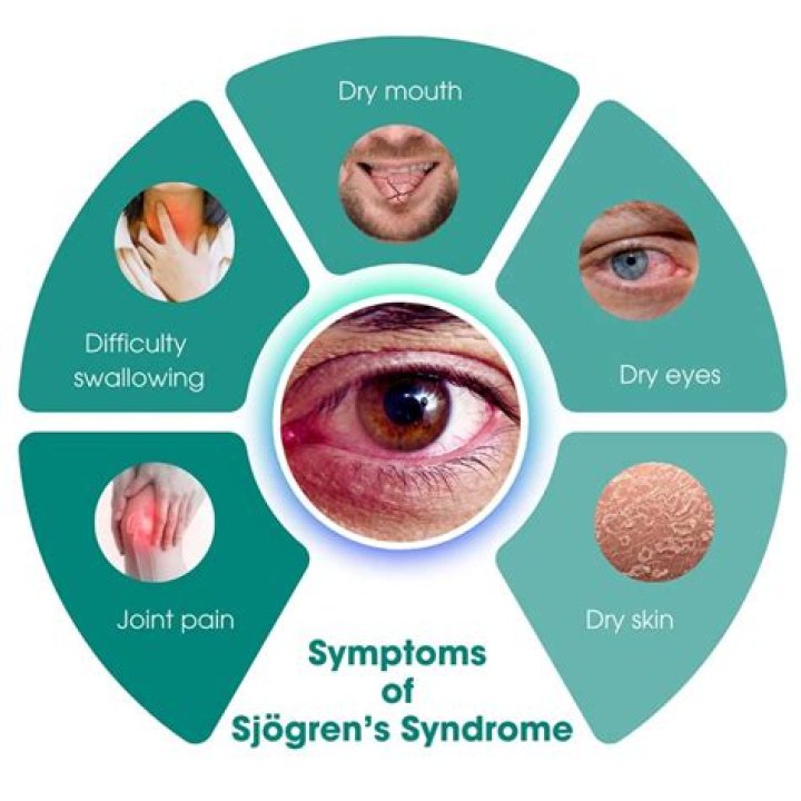Can you get disability for Sjogren's syndrome?
