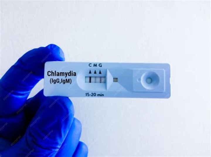 Can you get instant chlamydia results?