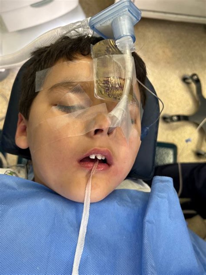 Can you go under anesthesia with braces?