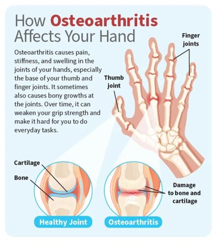 Can you have osteoarthritis throughout your whole body?