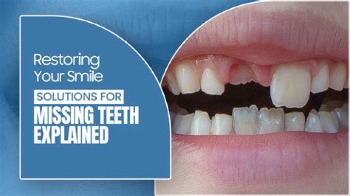 Can you live with a missing tooth?