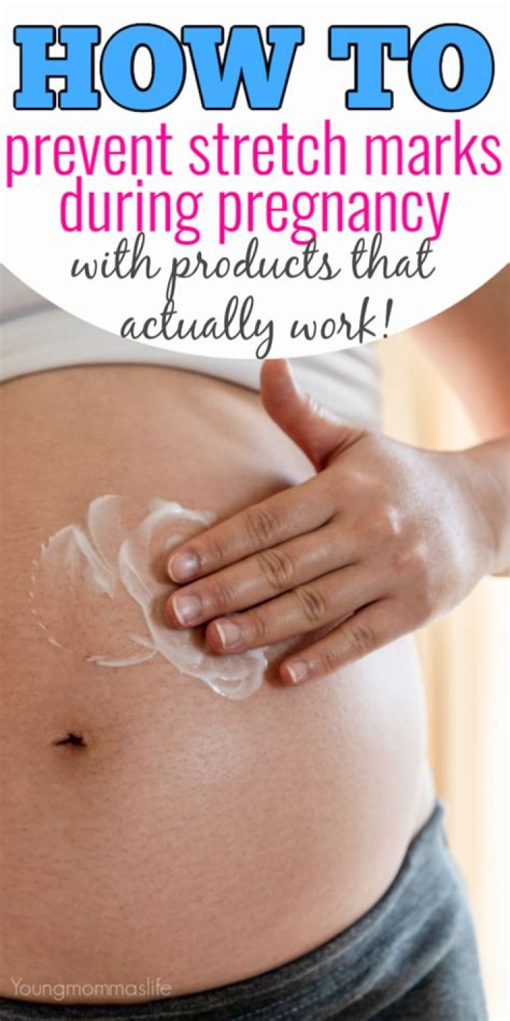Can you prevent pregnancy stretch marks?